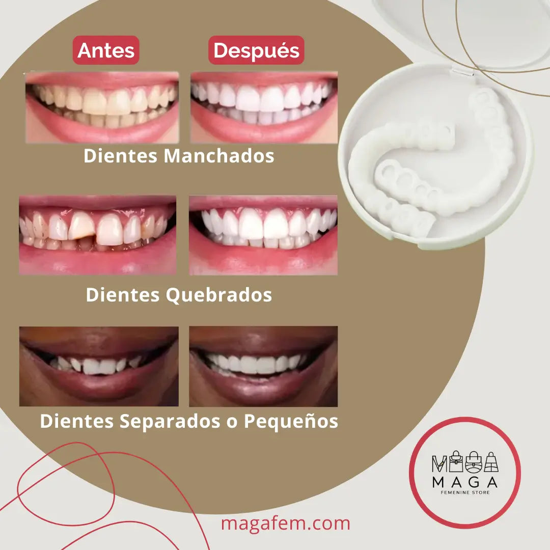 Moldura Dental Instantánea SNAPON®